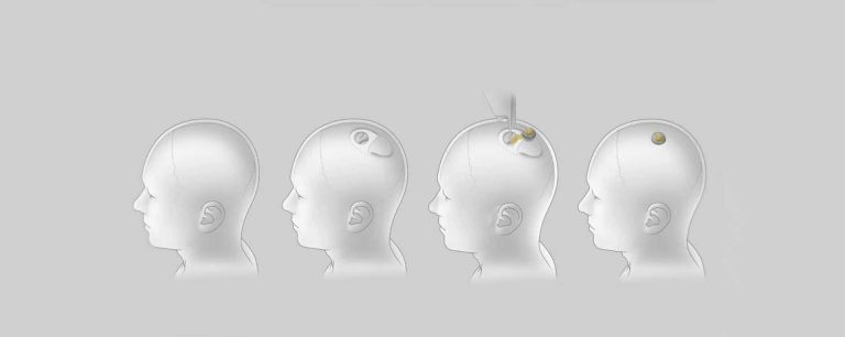 Neuralink импланти свињи